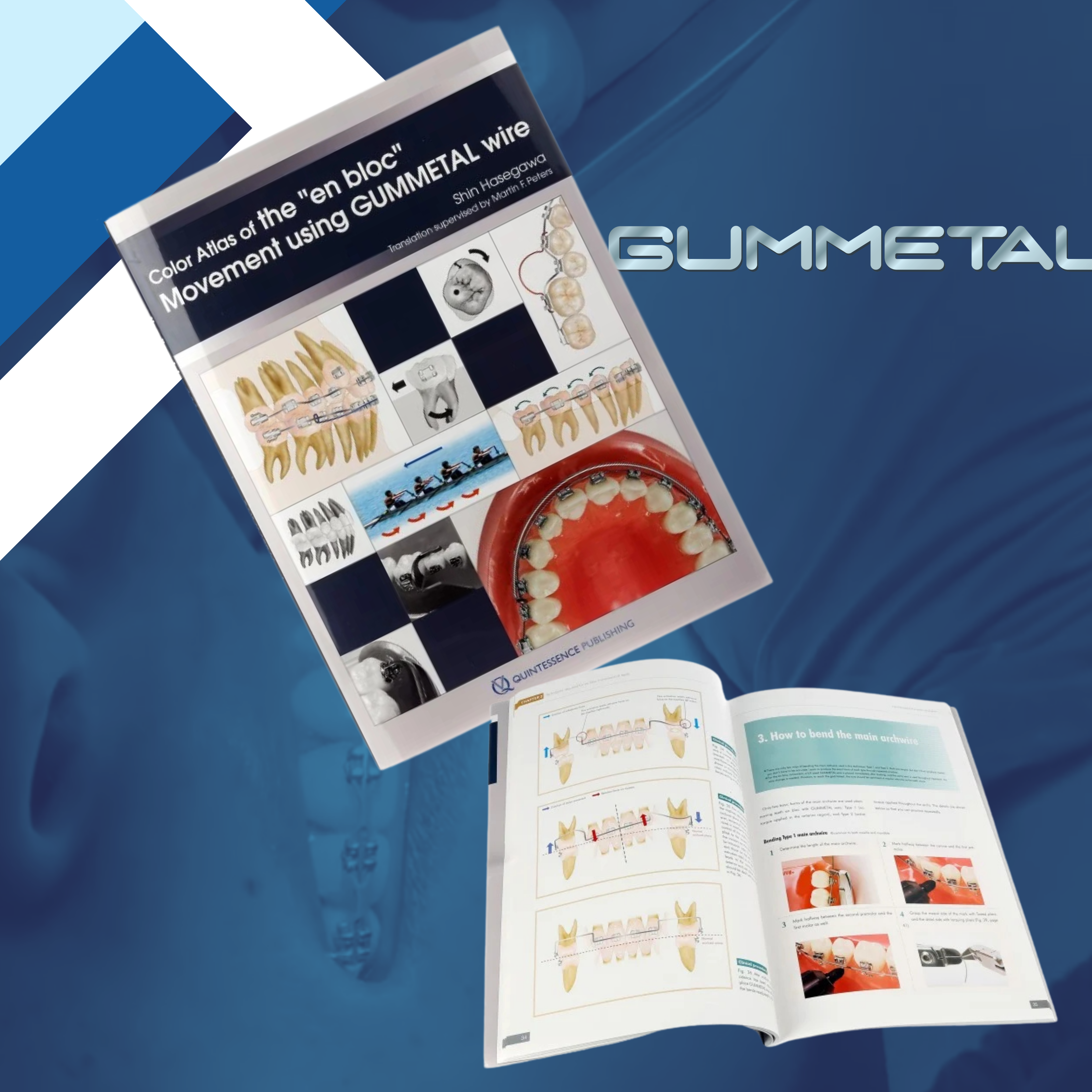 COLOR ATLAS OF THE “EN BLOC” MOVEMENT USING GUMMETAL WIRE