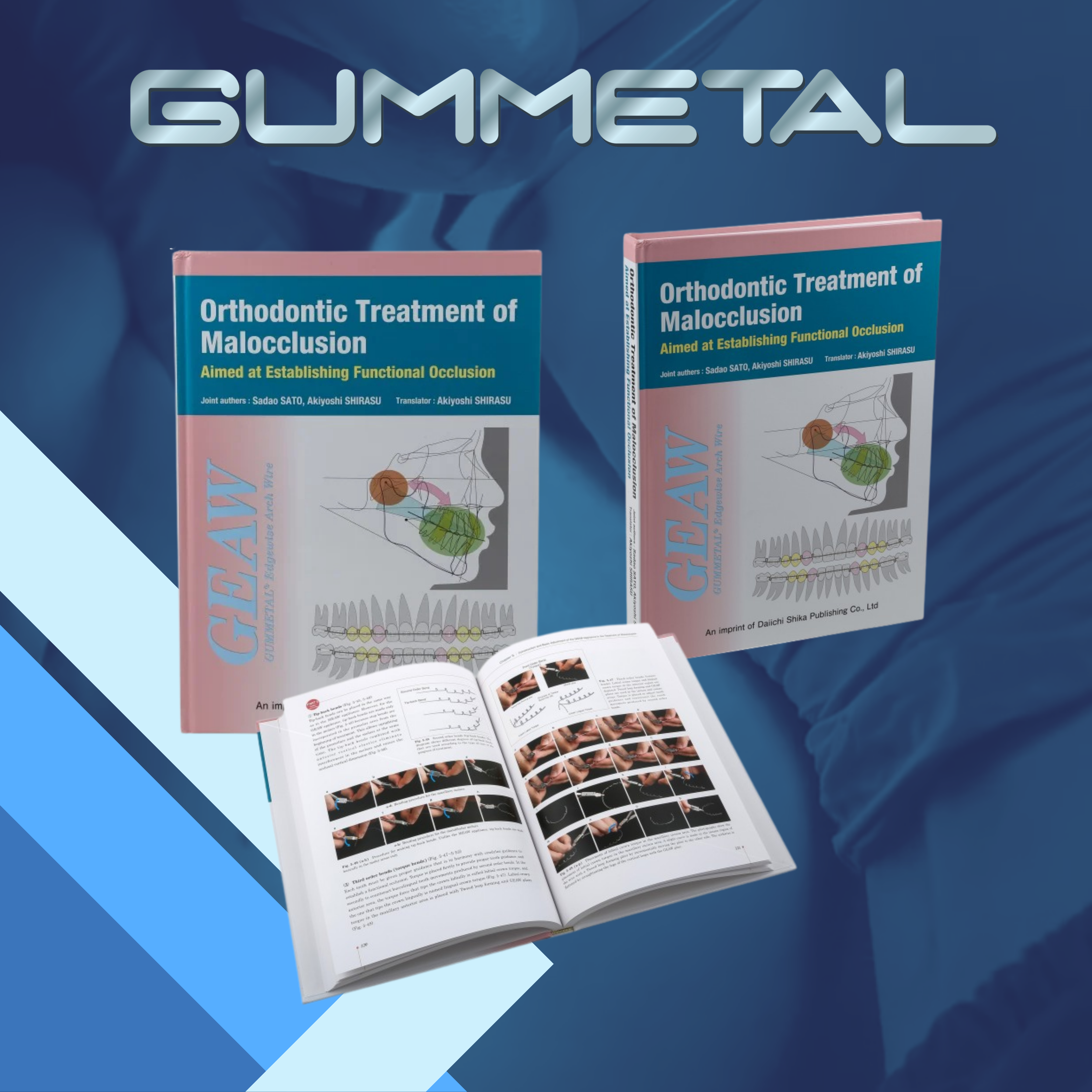 ORTHODONTIC TREATMENT OF MALOCCLUSION