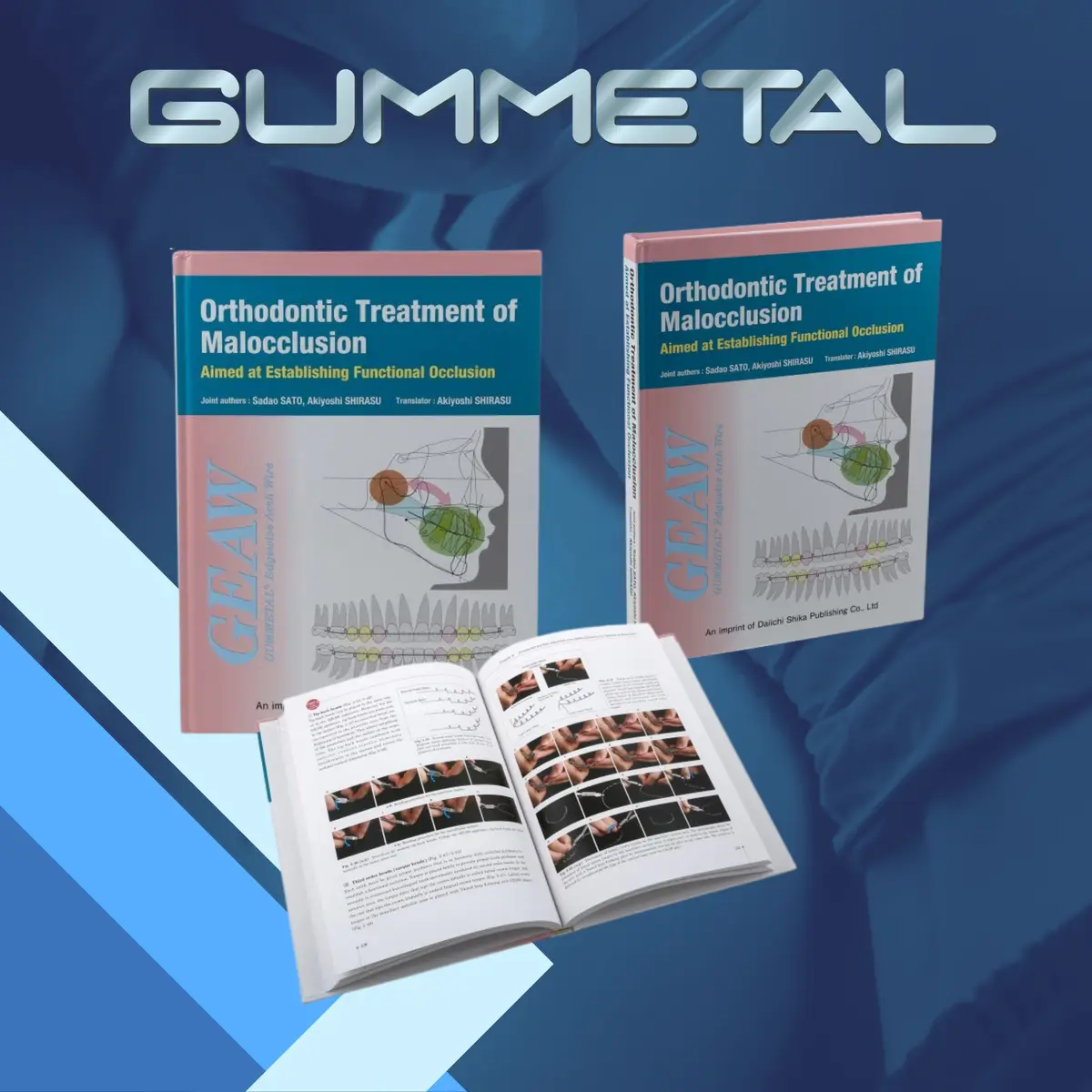 ORTHODONTIC TREATMENT OF MALOCCLUSION