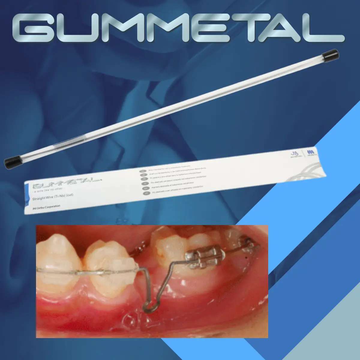 STRAIGHT WIRE (5 BARRAS)